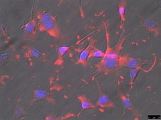 OSUMMER.7 Mouse NRAS-Mutant Melanoma Cell Line