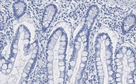 Anti-E-Cadherin Antibody, clone 1G14 ZooMAb&#174; Rabbit Monoclonal recombinant, expressed in HEK 293 cells