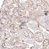 Anti-SMC6 antibody produced in rabbit Prestige Antibodies&#174; Powered by Atlas Antibodies, affinity isolated antibody, buffered aqueous glycerol solution
