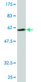 Monoclonal Anti-RPLP0 antibody produced in mouse clone 1B4, purified immunoglobulin, buffered aqueous solution