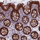 Anti-TRPM4 antibody produced in rabbit Prestige Antibodies&#174; Powered by Atlas Antibodies, affinity isolated antibody, buffered aqueous glycerol solution