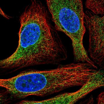 Anti-HM13 antibody produced in rabbit Prestige Antibodies&#174; Powered by Atlas Antibodies, affinity isolated antibody