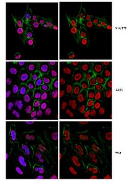 Anti-2,2,7-Trimethylguanosine Antibody, clone K121 clone K121, from mouse