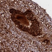Anti-WFDC2 antibody produced in rabbit Prestige Antibodies&#174; Powered by Atlas Antibodies, affinity isolated antibody, buffered aqueous glycerol solution