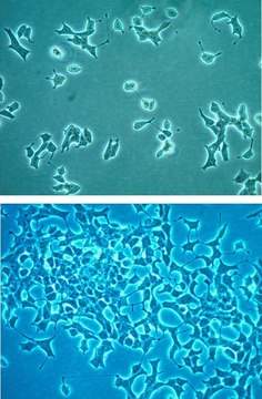 INS-1 832/3 Rat Insulinoma Cell Line INS-1 832/3 rat insulinoma cell line is a useful model for insulin secretion regulation and pancreatic islet beta-cell function studies.