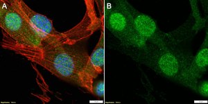 Anti-S100A4 Antibody, clone 1G2 ZooMAb&#174; Rabbit Monoclonal recombinant, expressed in HEK 293 cells