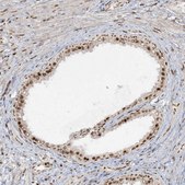 Anti-RBM10 antibody produced in rabbit Prestige Antibodies&#174; Powered by Atlas Antibodies, affinity isolated antibody, buffered aqueous glycerol solution