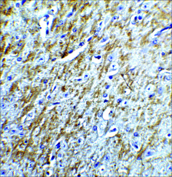 Anti-Survivin antibody produced in rabbit affinity isolated antibody, buffered aqueous solution