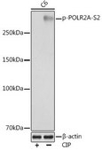 Anti-Phospho-POLR2A-S2 antibody produced in rabbit