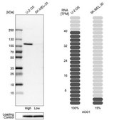 Anti-ACO1 antibody produced in rabbit Prestige Antibodies&#174; Powered by Atlas Antibodies, affinity isolated antibody, buffered aqueous glycerol solution, Ab1