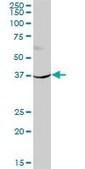 Anti-HSD11B2 antibody produced in mouse purified immunoglobulin, buffered aqueous solution