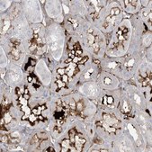 Anti-ATP11C antibody produced in rabbit Prestige Antibodies&#174; Powered by Atlas Antibodies, affinity isolated antibody, buffered aqueous glycerol solution