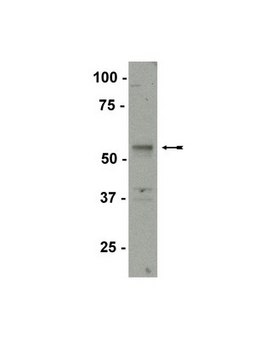 Anti-SF-1 Antibody Upstate&#174;, from rabbit