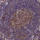 Anti-BRCA1 antibody produced in rabbit Prestige Antibodies&#174; Powered by Atlas Antibodies, affinity isolated antibody, buffered aqueous glycerol solution