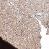 Monoclonal Anti-CHGB antibody produced in mouse Prestige Antibodies&#174; Powered by Atlas Antibodies, clone CL11404, purified immunoglobulin, buffered aqueous glycerol solution