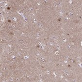 Anti-PGM2L1 antibody produced in rabbit Prestige Antibodies&#174; Powered by Atlas Antibodies, affinity isolated antibody, buffered aqueous glycerol solution