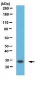 Anti-TFAM Antibody serum, from rabbit