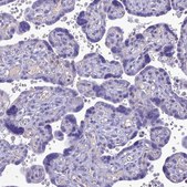 Anti-SLC13A5 antibody produced in rabbit Prestige Antibodies&#174; Powered by Atlas Antibodies, affinity isolated antibody, buffered aqueous glycerol solution
