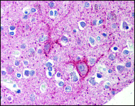 Anti-C12orf5 antibody produced in rabbit affinity isolated antibody, buffered aqueous solution