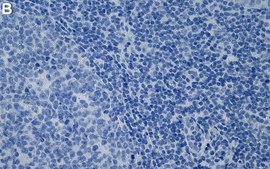 Anti-RRM1 Antibody, clone 1E20 ZooMAb&#174; Rabbit Monoclonal recombinant, expressed in HEK 293 cells