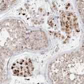 Anti-GGH antibody produced in rabbit Prestige Antibodies&#174; Powered by Atlas Antibodies, affinity isolated antibody, buffered aqueous glycerol solution