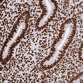 Anti-SFPQ antibody produced in rabbit Prestige Antibodies&#174; Powered by Atlas Antibodies, affinity isolated antibody, buffered aqueous glycerol solution