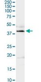 Anti-ADA antibody produced in rabbit purified immunoglobulin, buffered aqueous solution