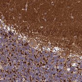 Anti-DMXL2 antibody produced in rabbit Prestige Antibodies&#174; Powered by Atlas Antibodies, affinity isolated antibody, buffered aqueous glycerol solution