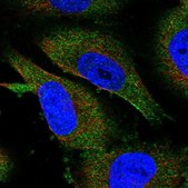 Anti-METTL13 antibody produced in rabbit Prestige Antibodies&#174; Powered by Atlas Antibodies, affinity isolated antibody, buffered aqueous glycerol solution