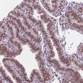 Anti-UBN1 antibody produced in rabbit Prestige Antibodies&#174; Powered by Atlas Antibodies, affinity isolated antibody, buffered aqueous glycerol solution
