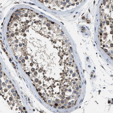 Anti-STK33 antibody produced in rabbit Prestige Antibodies&#174; Powered by Atlas Antibodies, affinity isolated antibody, buffered aqueous glycerol solution