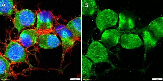 Anti-CRFR1/CRHR1 Antibody, clone 1N21 ZooMAb&#174; Rabbit Monoclonal recombinant, expressed in HEK 293 cells