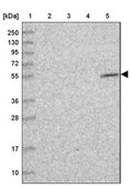 Anti-UTP4 antibody produced in rabbit Prestige Antibodies&#174; Powered by Atlas Antibodies, affinity isolated antibody, buffered aqueous glycerol solution