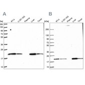 Anti-MT-CO2 antibody produced in rabbit Prestige Antibodies&#174; Powered by Atlas Antibodies, affinity isolated antibody, buffered aqueous glycerol solution