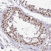 Anti-SIN3A antibody produced in rabbit Prestige Antibodies&#174; Powered by Atlas Antibodies, affinity isolated antibody, buffered aqueous glycerol solution