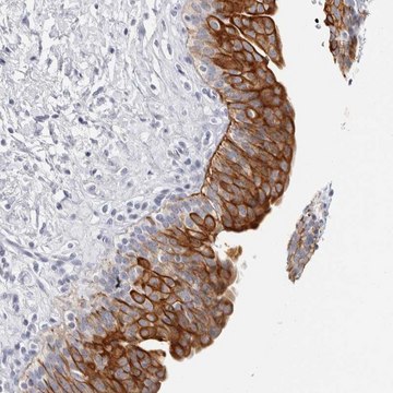 Anti-RPH3AL antibody produced in rabbit Prestige Antibodies&#174; Powered by Atlas Antibodies, affinity isolated antibody, buffered aqueous glycerol solution