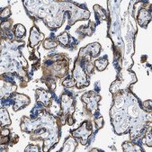 Anti-ITGA6 antibody produced in rabbit Prestige Antibodies&#174; Powered by Atlas Antibodies, affinity isolated antibody, buffered aqueous glycerol solution