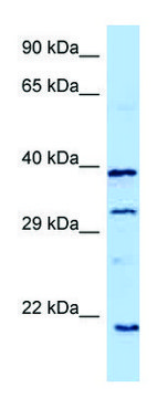 Anti-GH1 (C-terminal) antibody produced in rabbit affinity isolated antibody