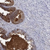 Anti-ANO7 antibody produced in rabbit Prestige Antibodies&#174; Powered by Atlas Antibodies, affinity isolated antibody, buffered aqueous glycerol solution