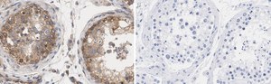 Anti-mTOR Antibody, clone 4O5 ZooMAb&#174; Rabbit Monoclonal recombinant, expressed in HEK 293 cells
