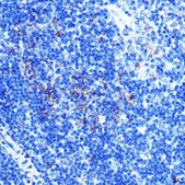 Anti-ATP5A1 antibody produced in rabbit