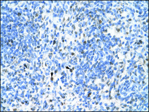 Anti-PCNA IgG fraction of antiserum