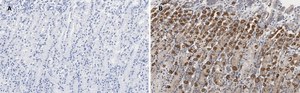 Anti-IKB &#945; Antibody, clone 6O8, ZooMAb&#174; Rabbit Monoclonal recombinant, expressed in HEK 293 cells