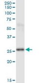 Monoclonal Anti-PSPH antibody produced in mouse clone 3A5, purified immunoglobulin, buffered aqueous solution