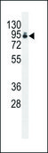 ANTI-PAP (CENTER) antibody produced in rabbit IgG fraction of antiserum, buffered aqueous solution