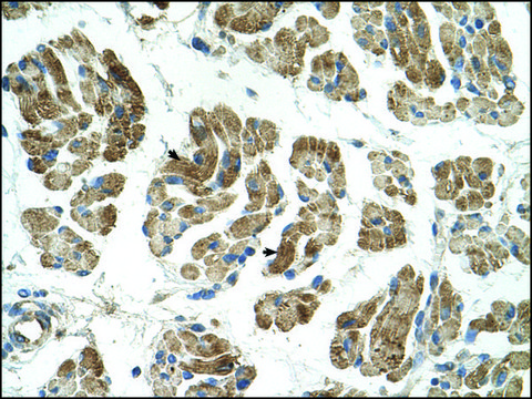 Anti-RHOT1 antibody produced in rabbit affinity isolated antibody