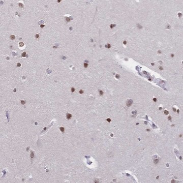 Anti-CBX7 antibody produced in rabbit Prestige Antibodies&#174; Powered by Atlas Antibodies, affinity isolated antibody, buffered aqueous glycerol solution