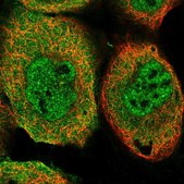 Anti-TRIM26 antibody produced in rabbit Prestige Antibodies&#174; Powered by Atlas Antibodies, affinity isolated antibody, buffered aqueous glycerol solution