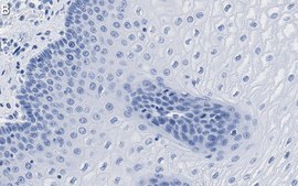 Anti-Involucrin Antibody, clone 1D13 ZooMAb&#174; Rabbit Monoclonal recombinant, expressed in HEK 293 cells