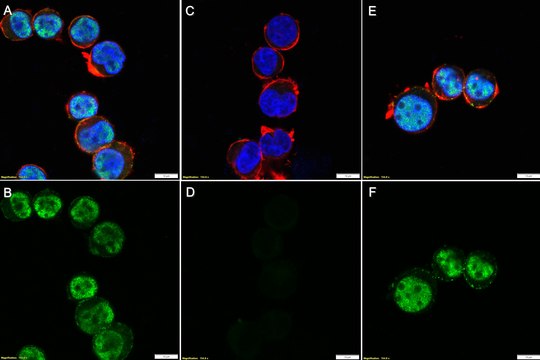 Anti-phospho ABL1 (Tyr245) Antibody, clone 3F7 ZooMAb&#174; Rabbit Monoclonal recombinant, expressed in HEK 293 cells